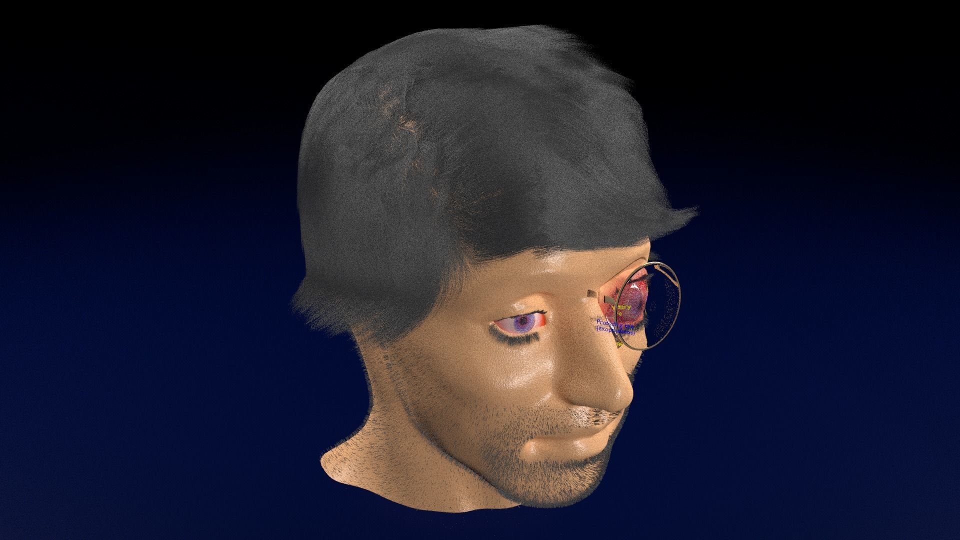 Thyroid eye lesions 3D model_81