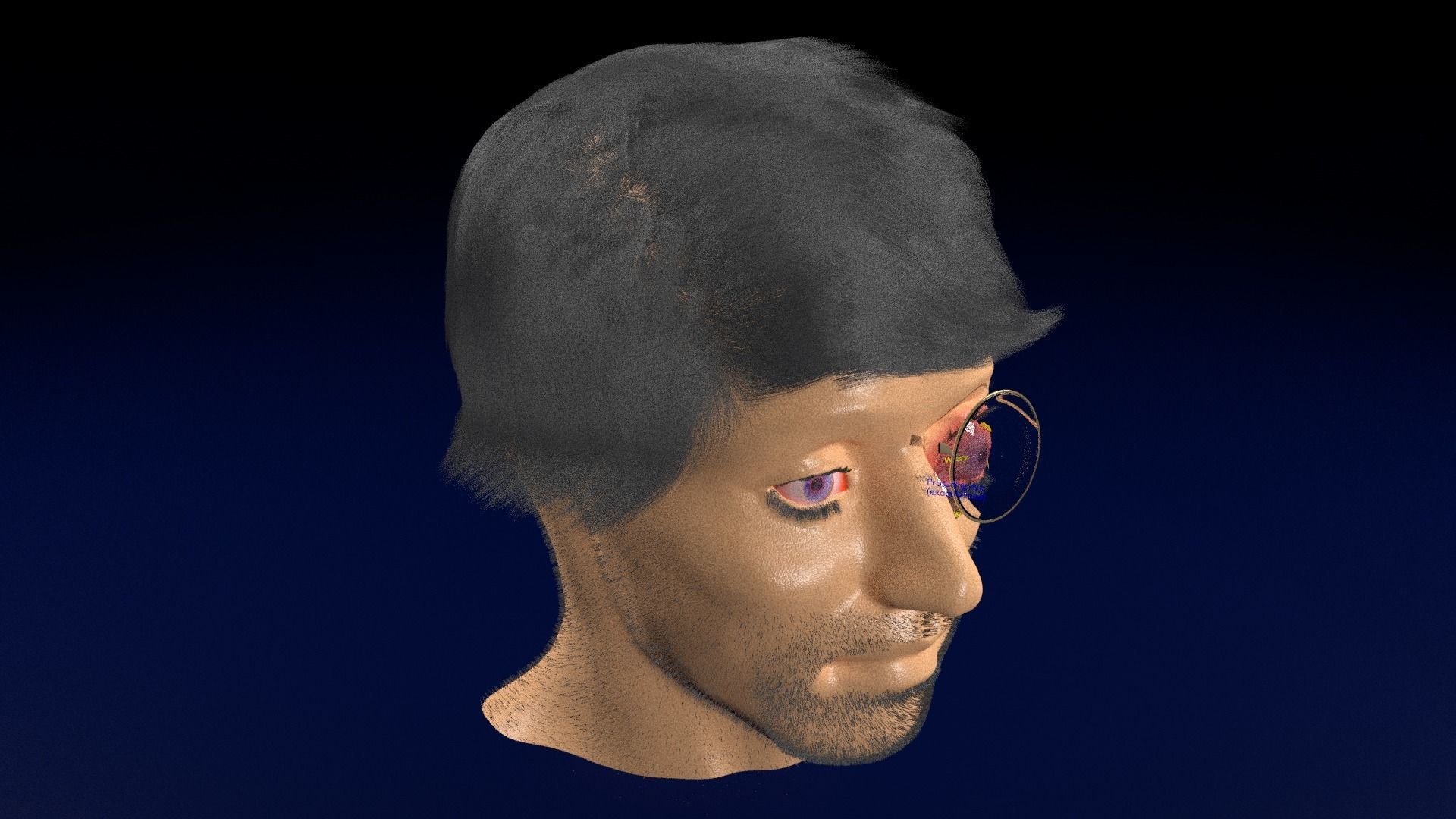 Thyroid eye lesions 3D model_111