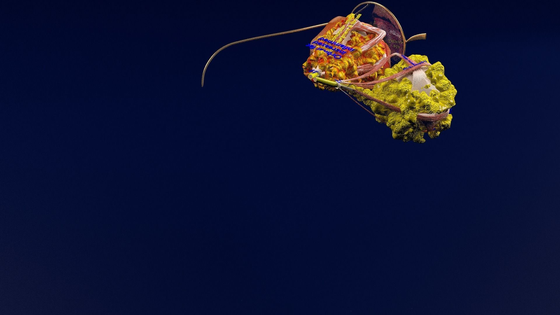 Thyroid eye lesions 3D model_30