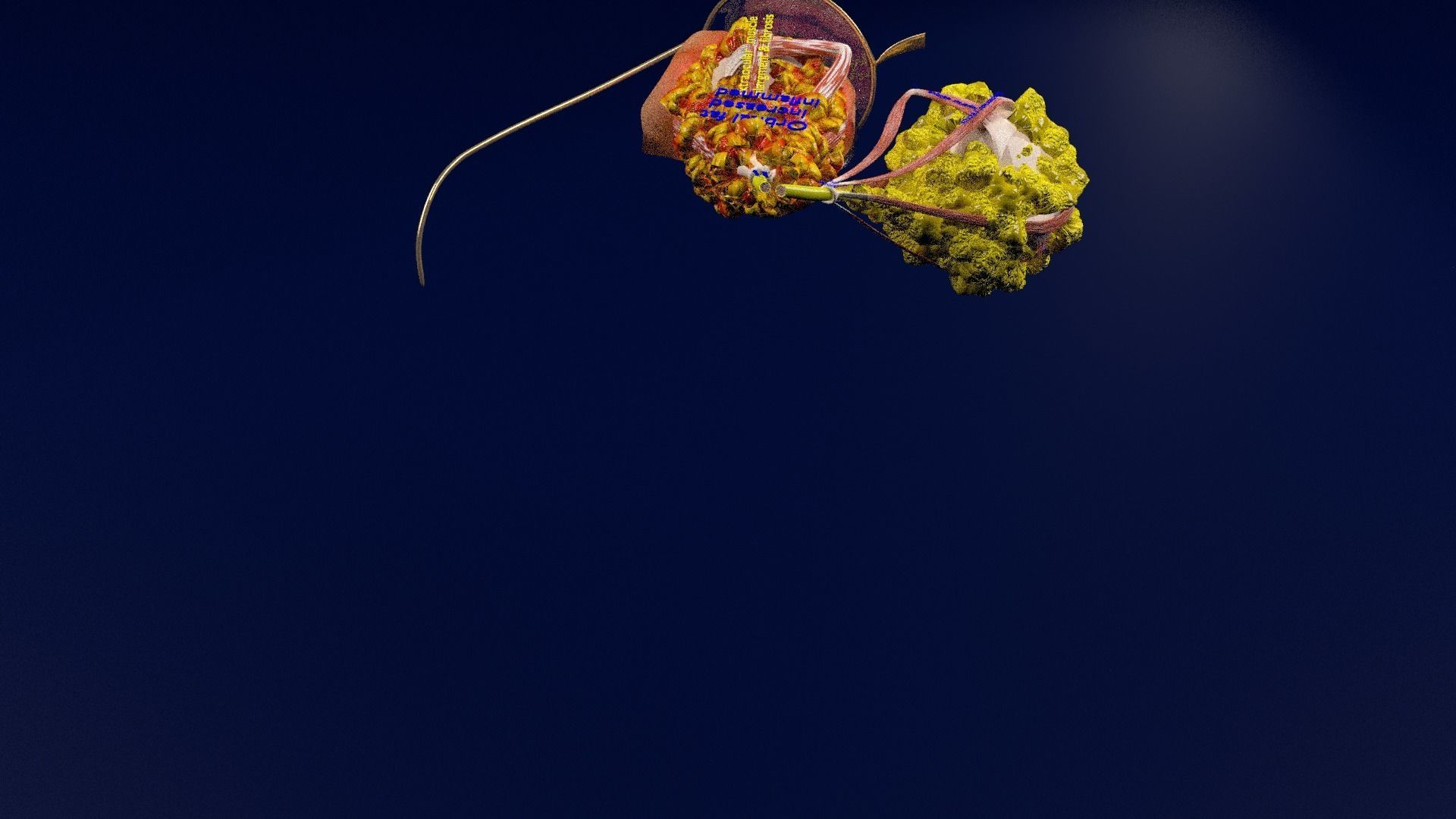 Thyroid eye lesions 3D model_55