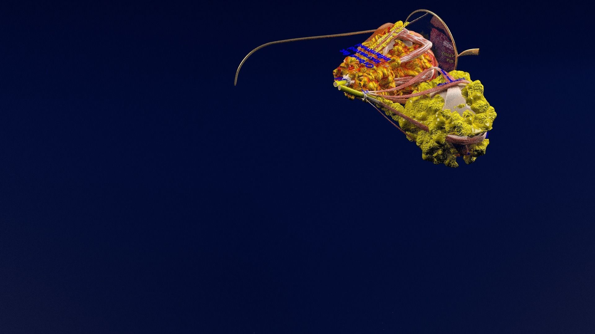 Thyroid eye lesions 3D model_37