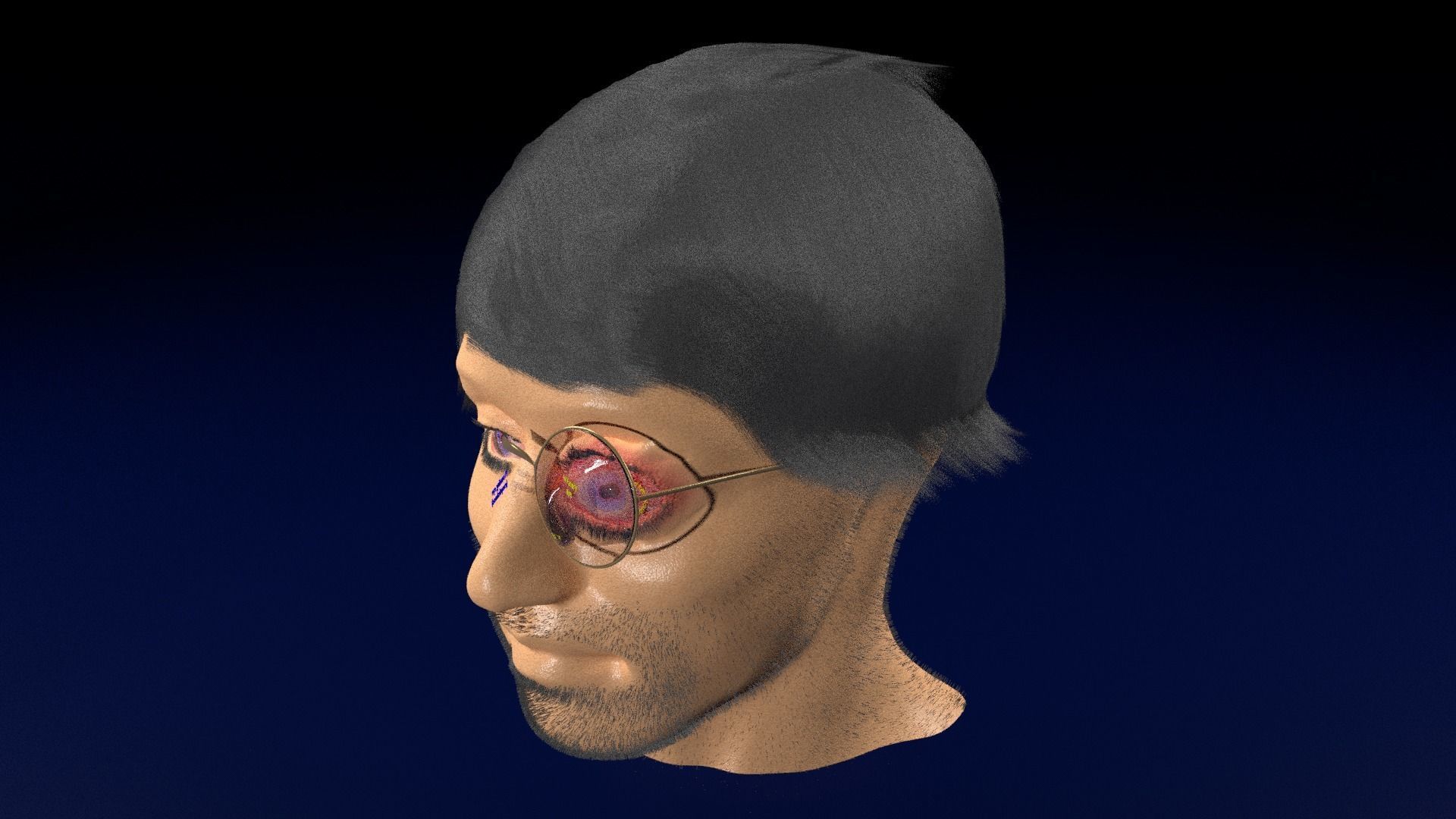 Thyroid eye lesions 3D model_72