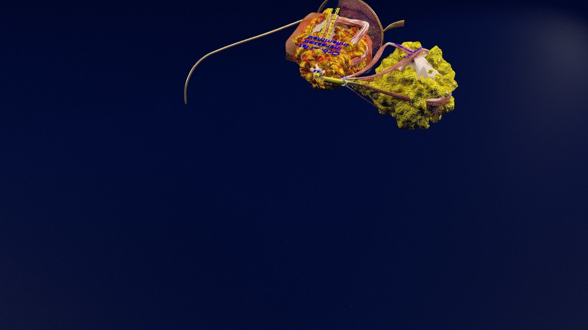 Thyroid eye lesions 3D model_63