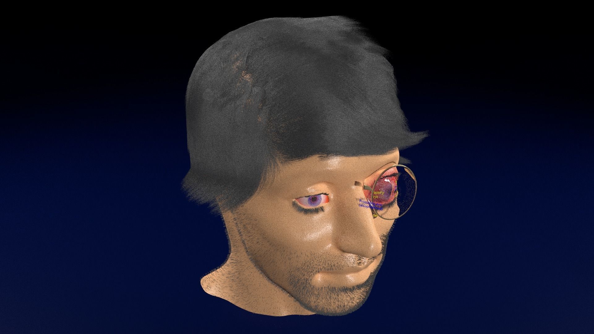 Thyroid eye lesions 3D model_99