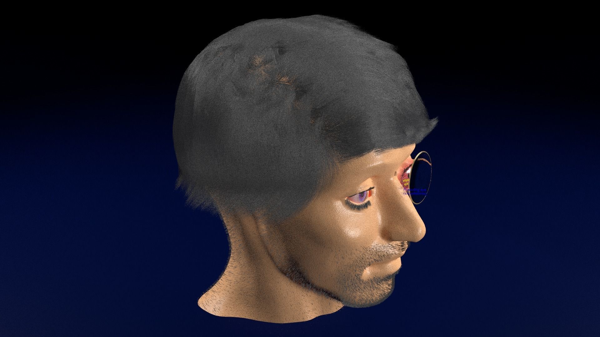Thyroid eye lesions 3D model_76