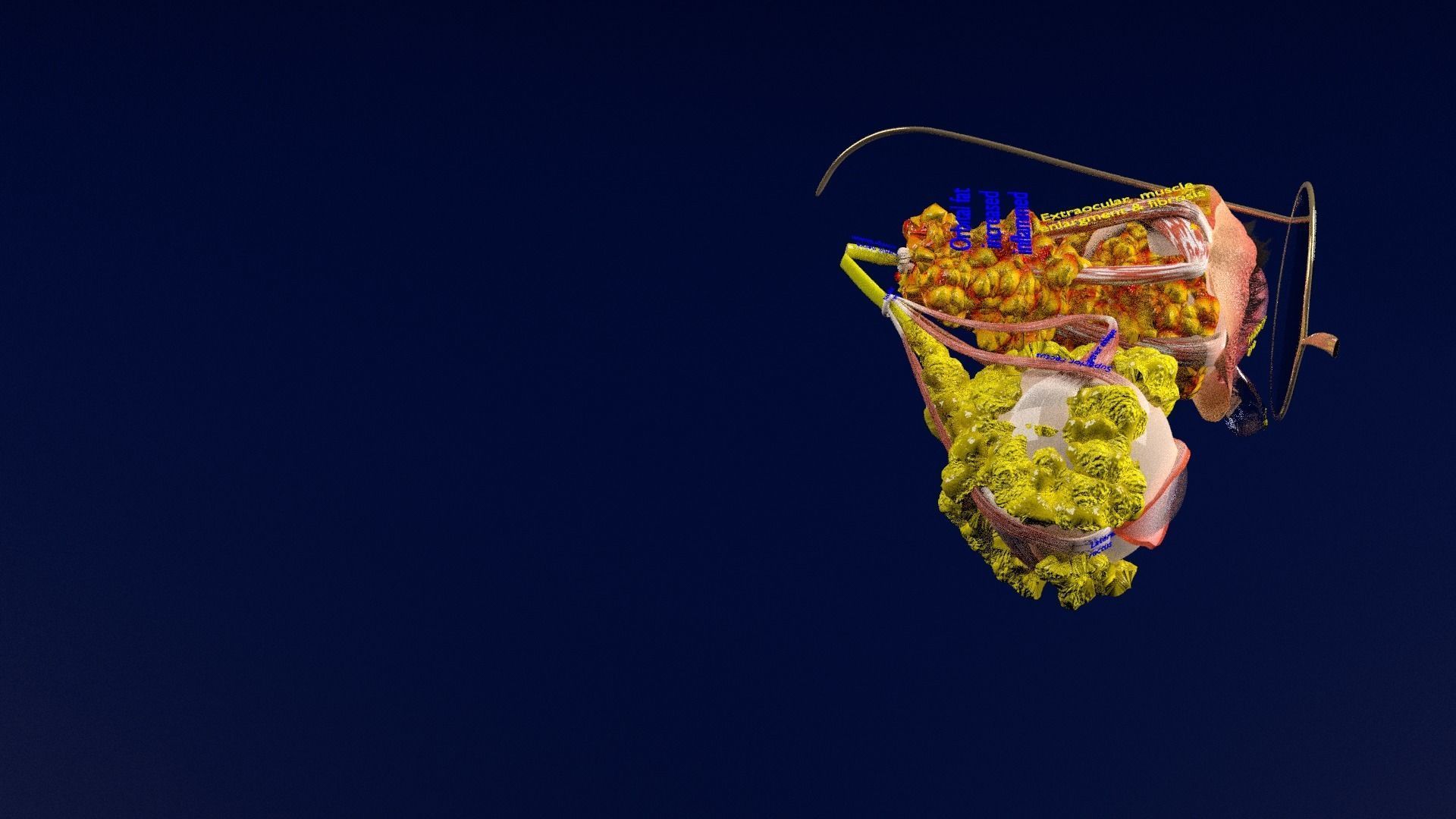 Thyroid eye lesions 3D model_41