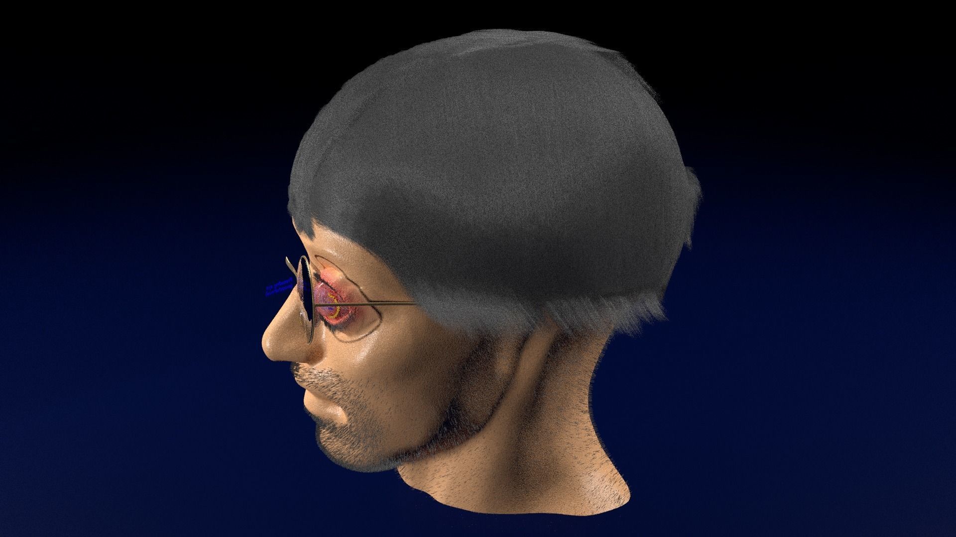 Thyroid eye lesions 3D model_120