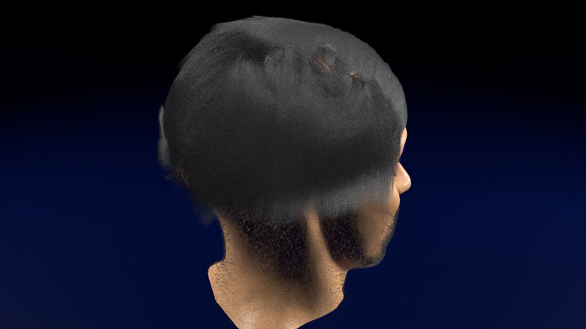 Thyroid eye lesions 3D model_67