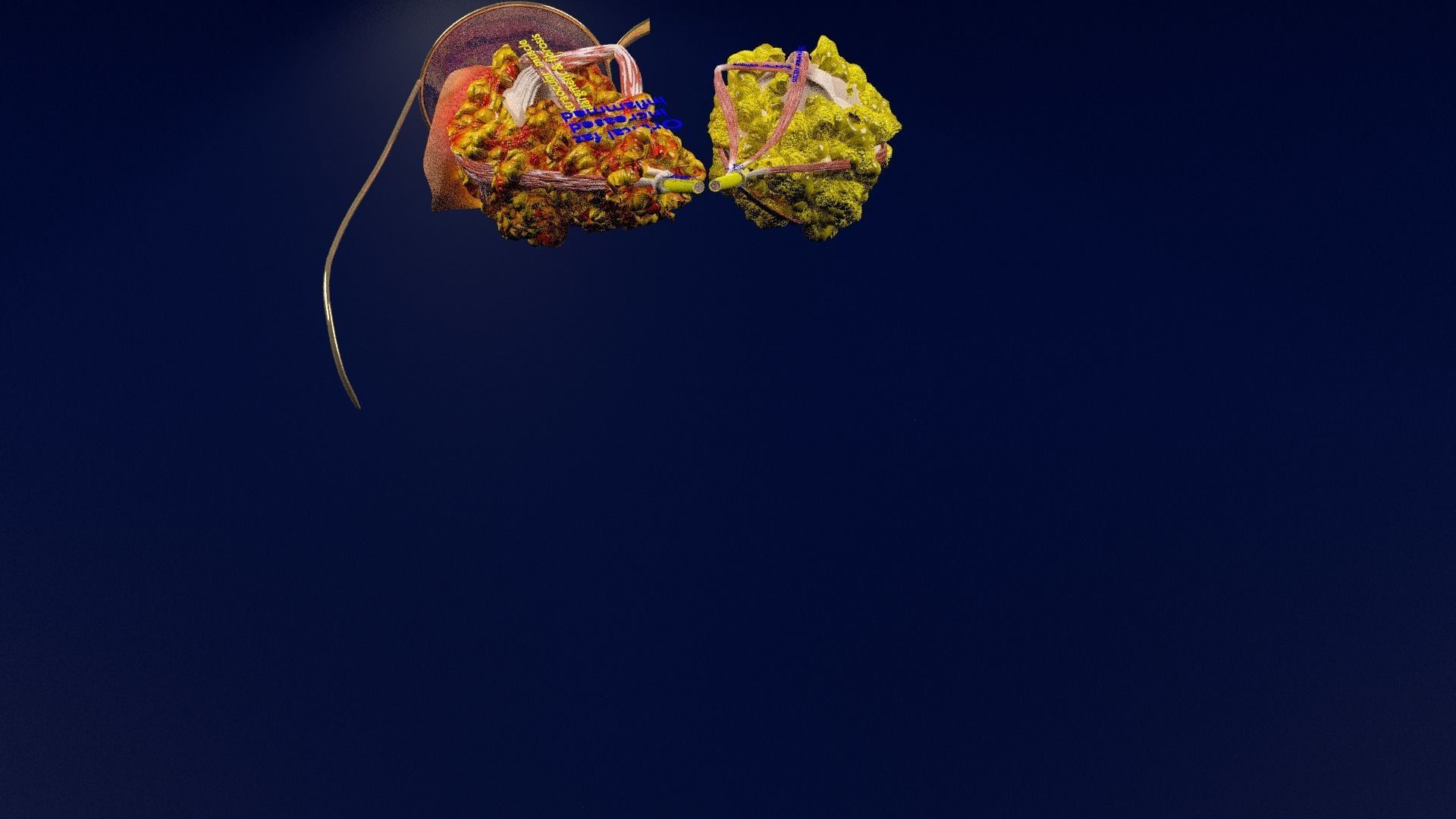 Thyroid eye lesions 3D model_62