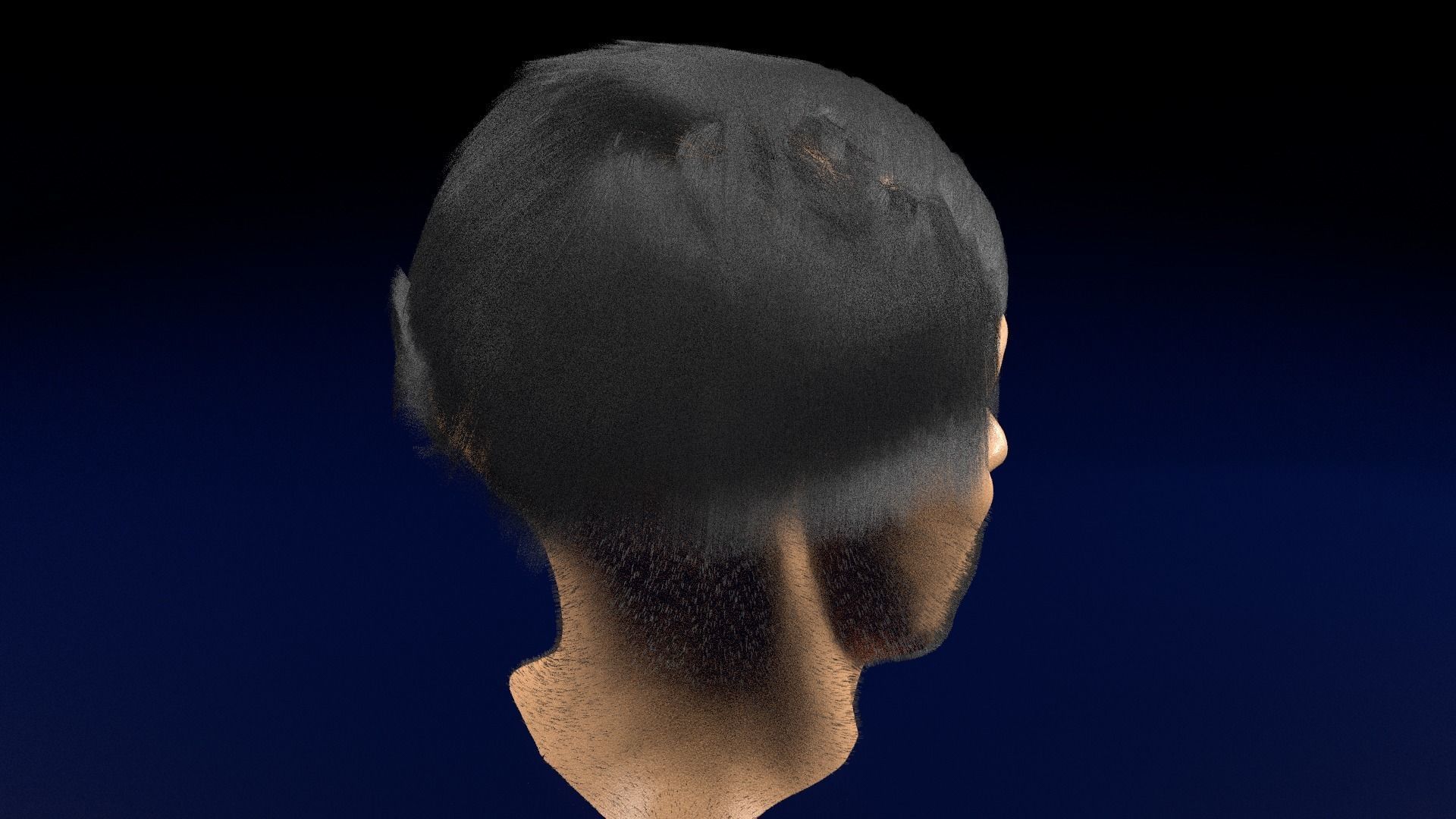 Thyroid eye lesions 3D model_103