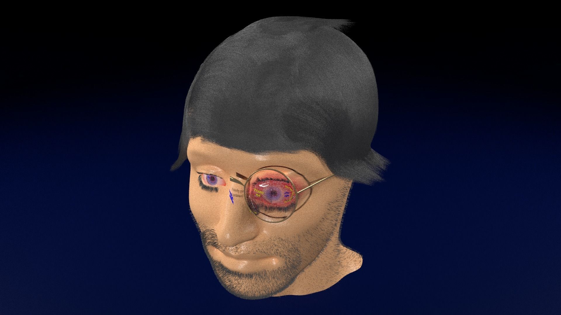 Thyroid eye lesions 3D model_88