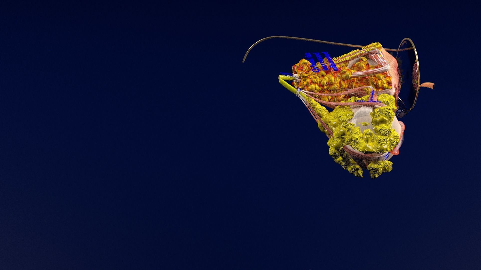 Thyroid eye lesions 3D model_40