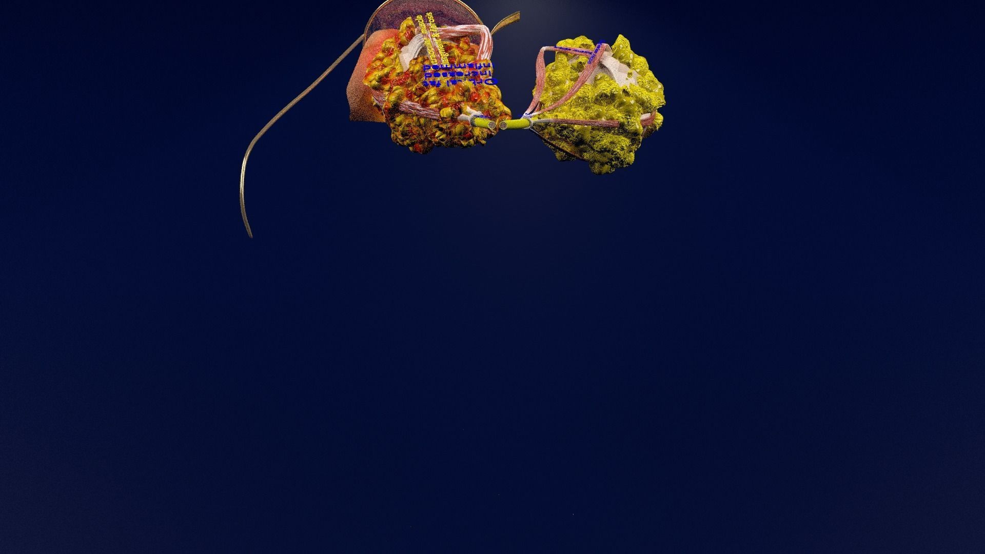 Thyroid eye lesions 3D model_66