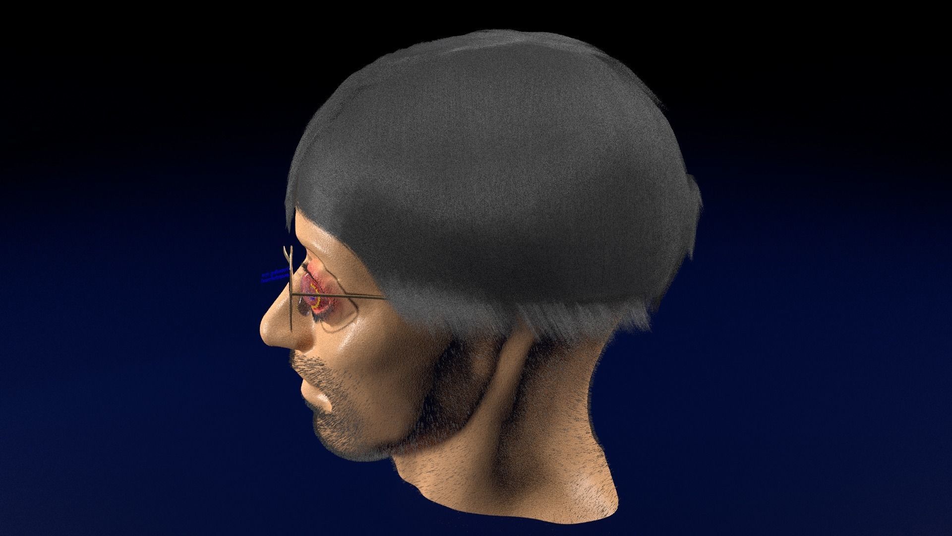 Thyroid eye lesions 3D model_102