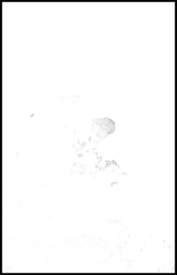 Germany High resolution 14k cavity map Texture_4