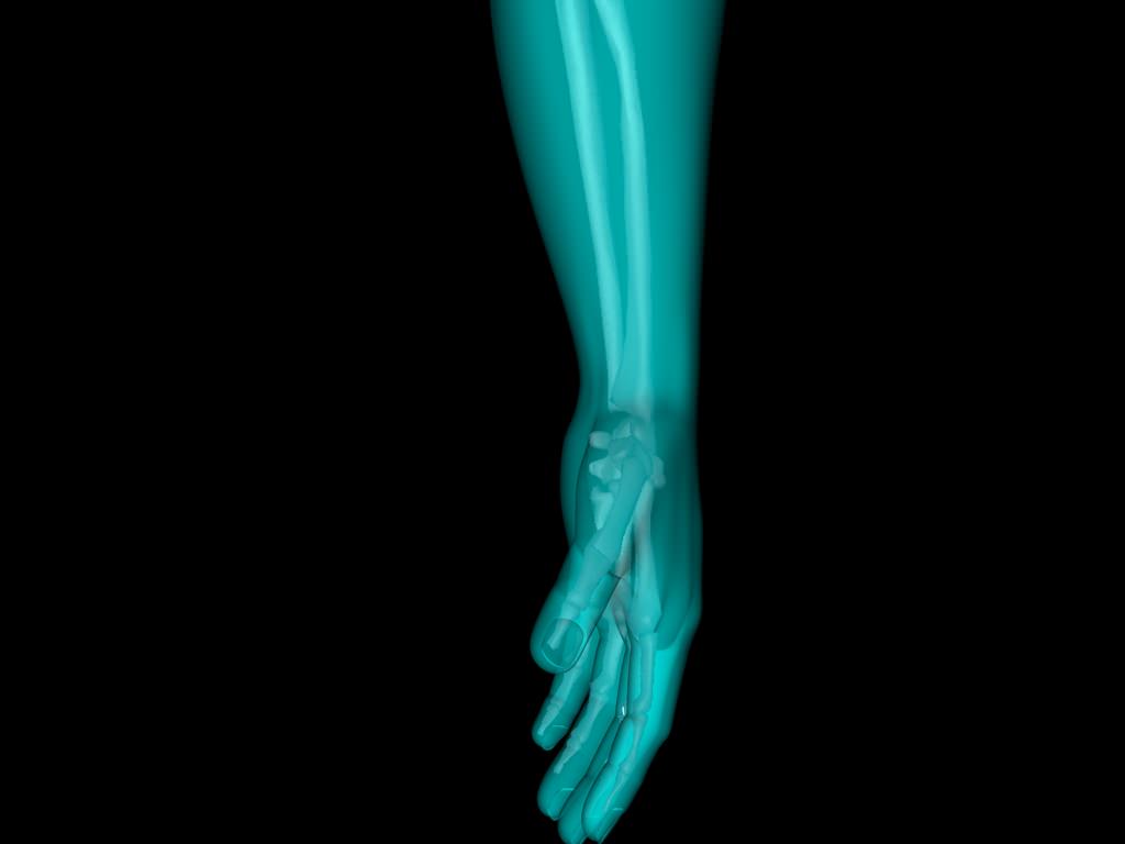 X Ray Hand Medically Accurate 3d Model 3D model_17