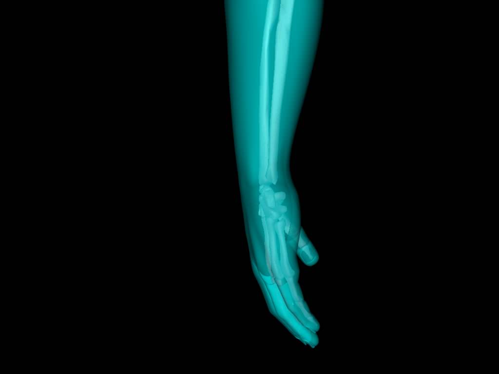 X Ray Hand Medically Accurate 3d Model 3D model_35