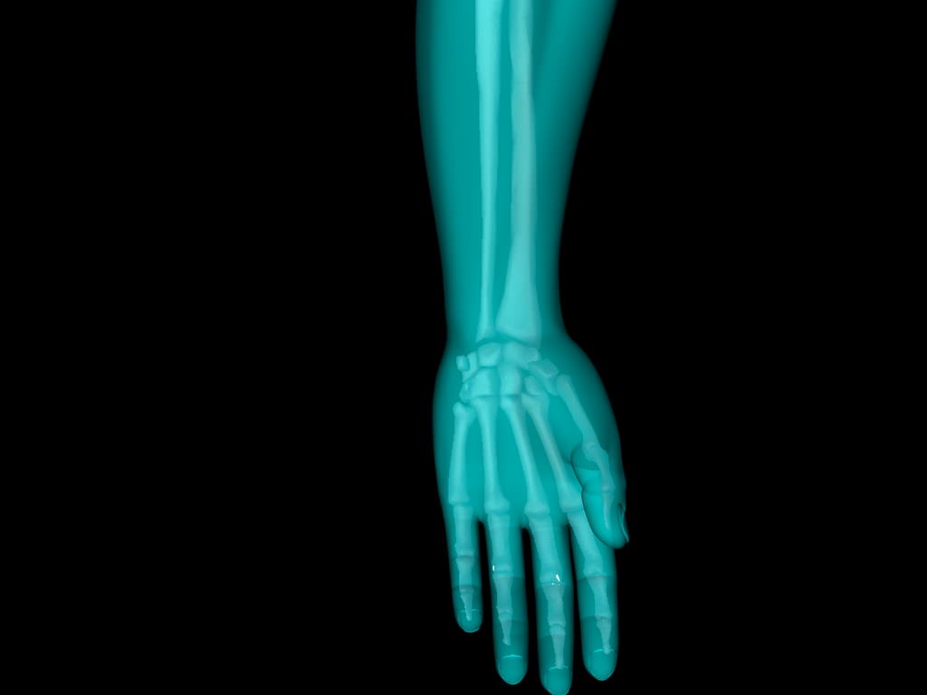 X Ray Hand Medically Accurate 3d Model 3D model_23