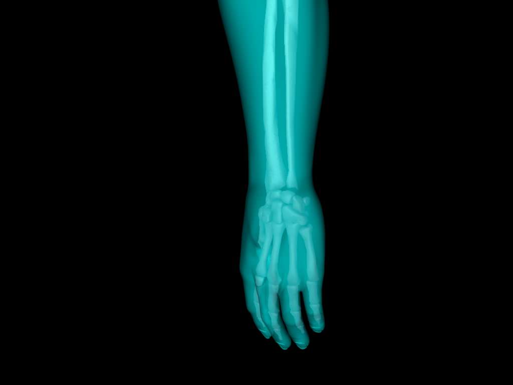 X Ray Hand Medically Accurate 3d Model 3D model_40