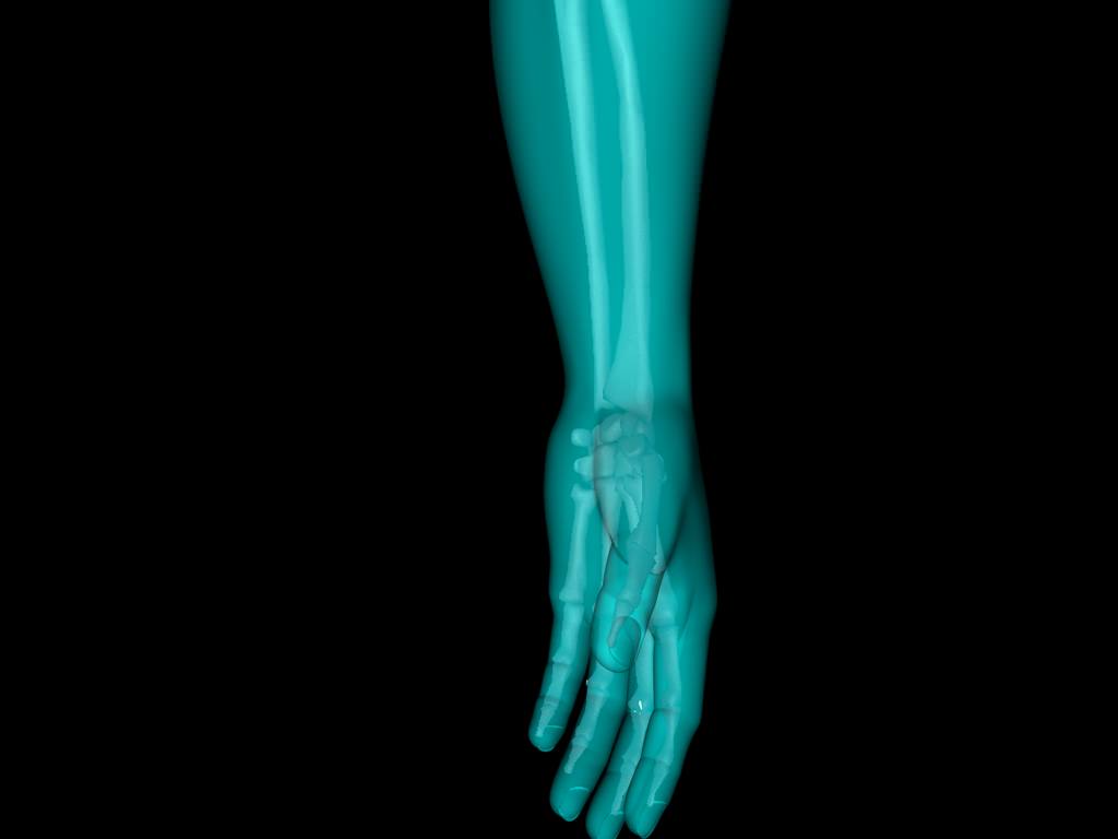 X Ray Hand Medically Accurate 3d Model 3D model_19