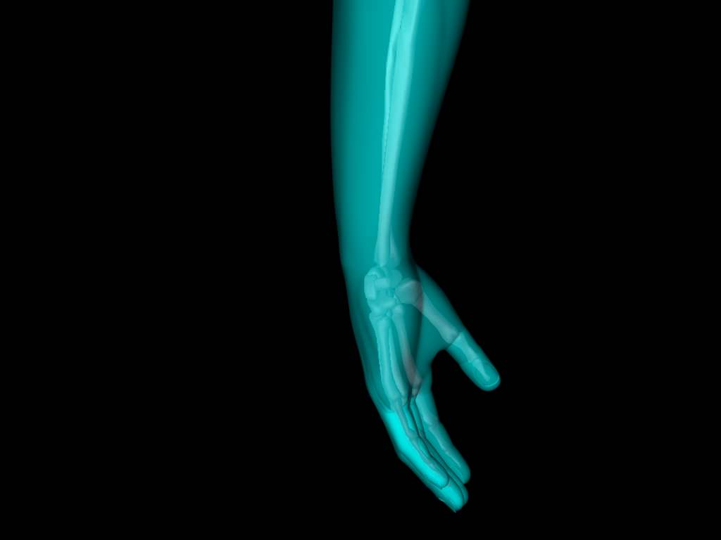 X Ray Hand Medically Accurate 3d Model 3D model_32
