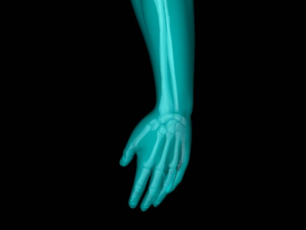 X Ray Hand Medically Accurate 3d Model 3D model_50