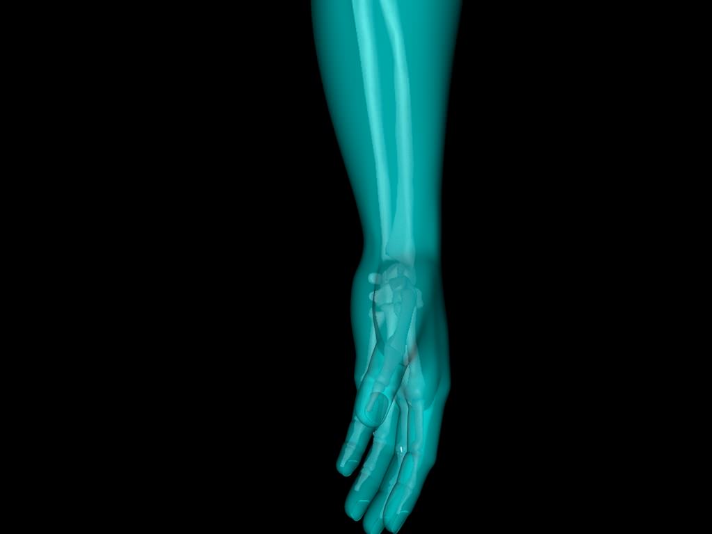 X Ray Hand Medically Accurate 3d Model 3D model_18