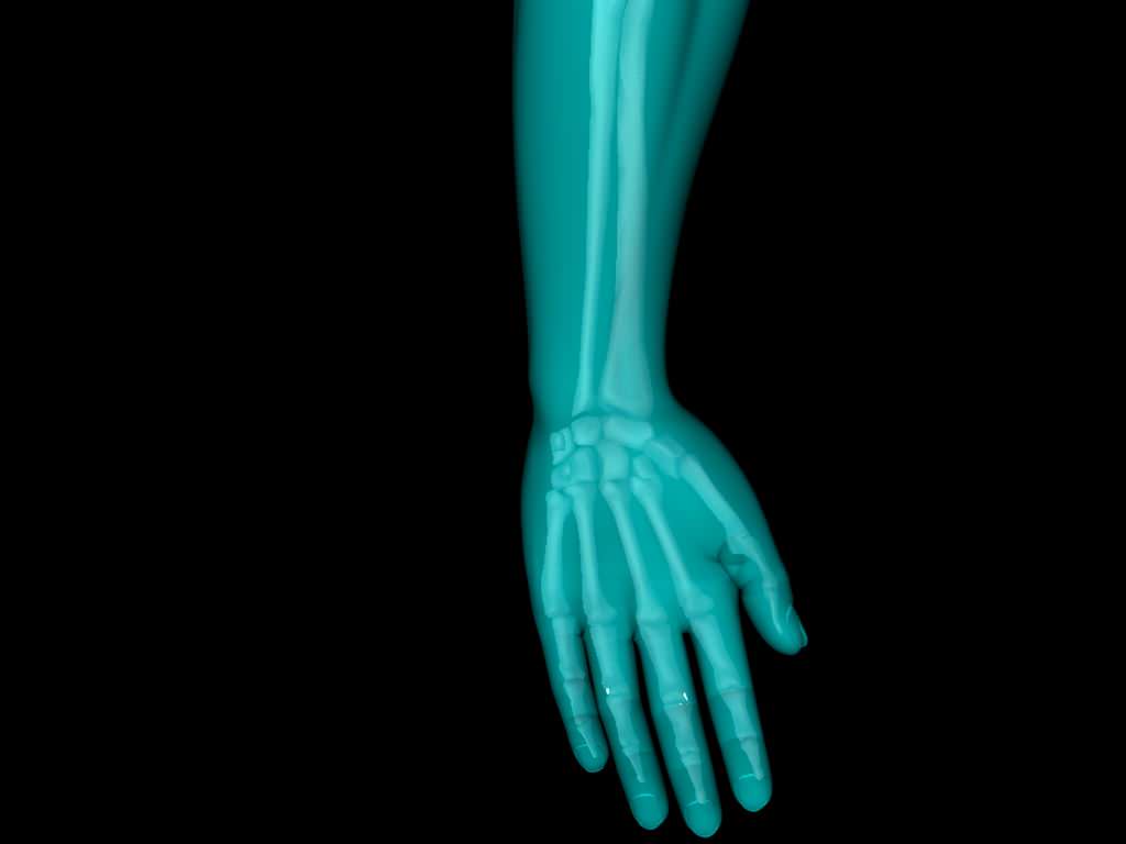 X Ray Hand Medically Accurate 3d Model 3D model_25