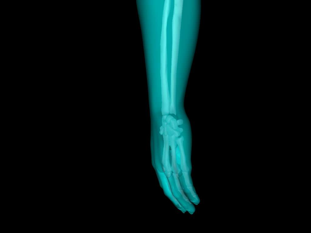 X Ray Hand Medically Accurate 3d Model 3D model_37