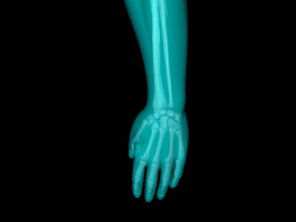 X Ray Hand Medically Accurate 3d Model 3D model_45