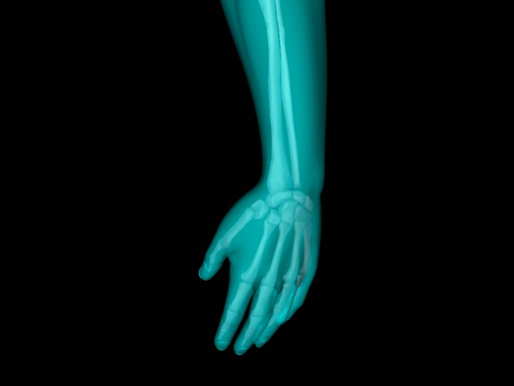 X Ray Hand Medically Accurate 3d Model 3D model_51