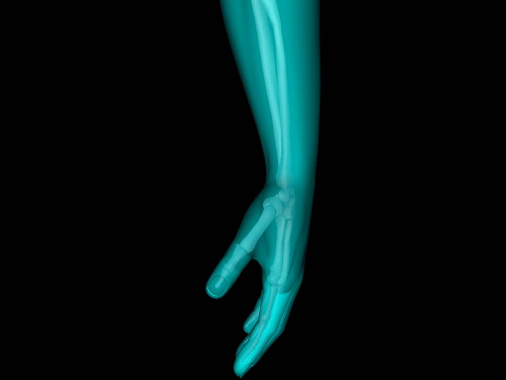X Ray Hand Medically Accurate 3d Model 3D model_14