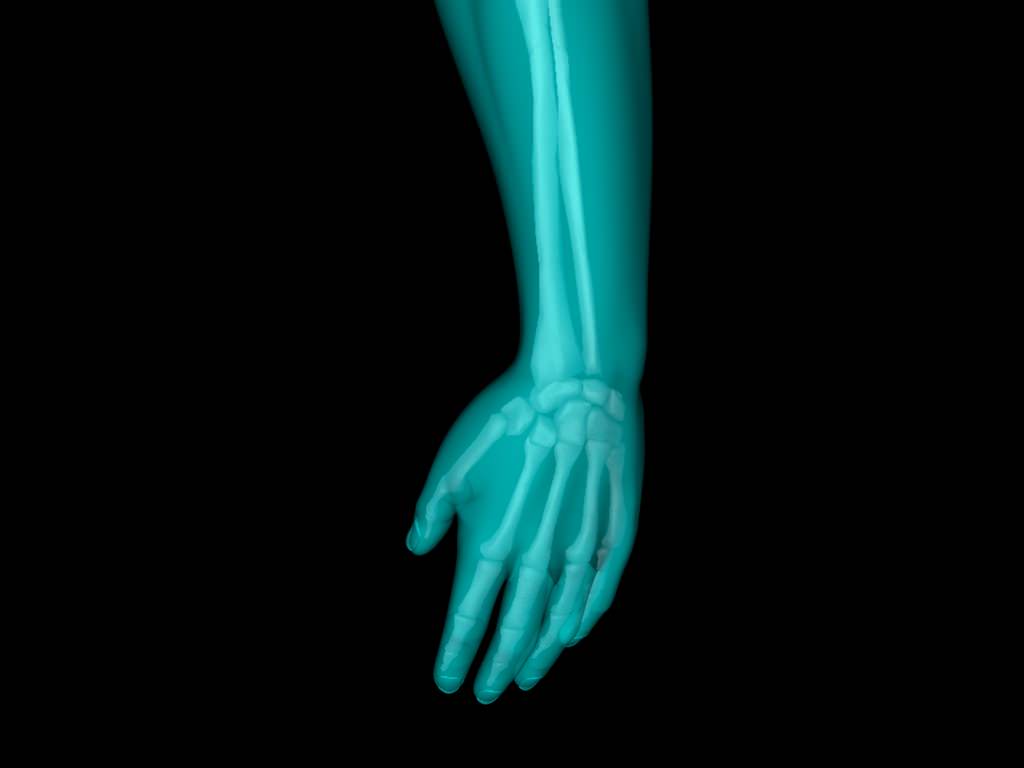 X Ray Hand Medically Accurate 3d Model 3D model_49