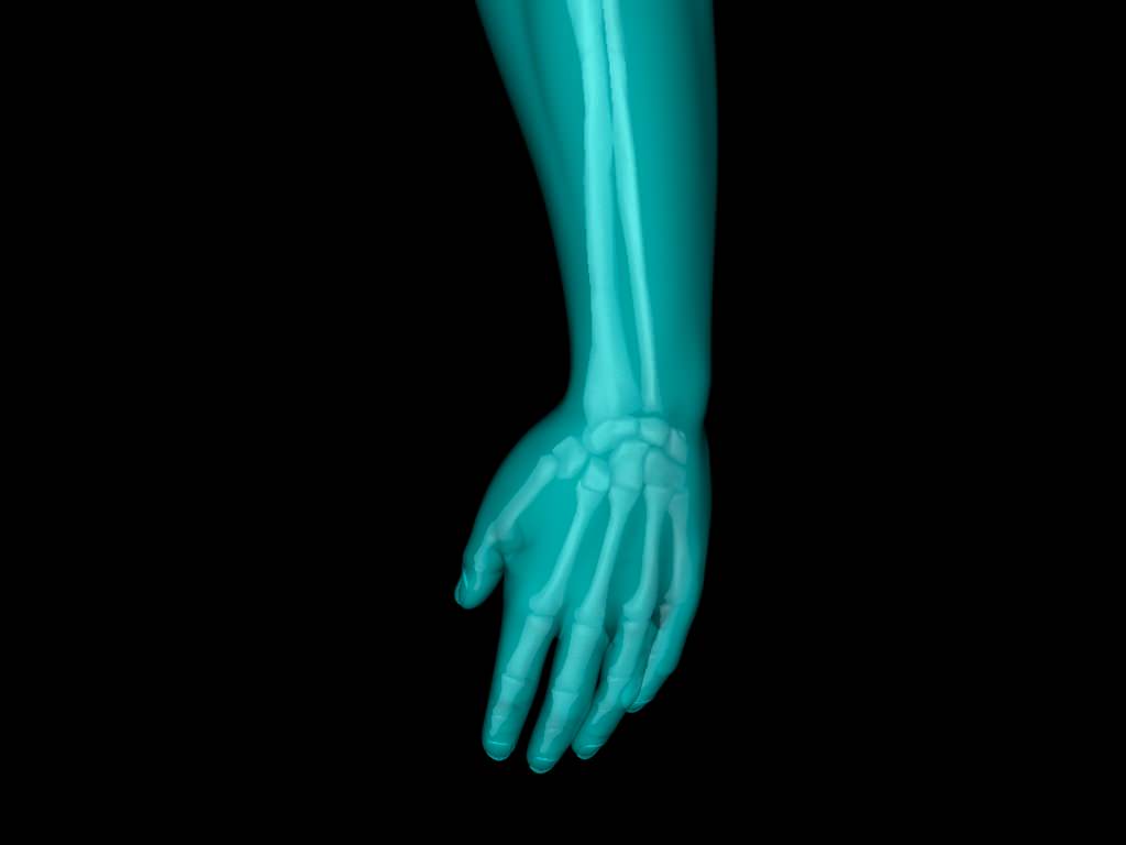 X Ray Hand Medically Accurate 3d Model 3D model_48