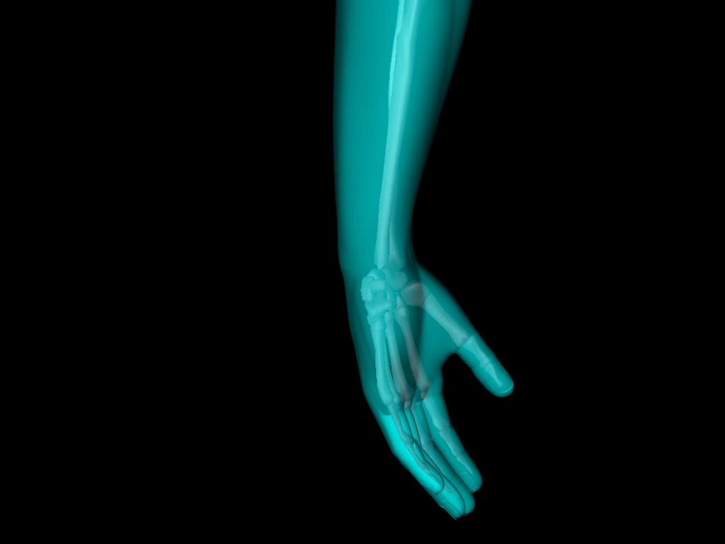 X Ray Hand Medically Accurate 3d Model 3D model_31