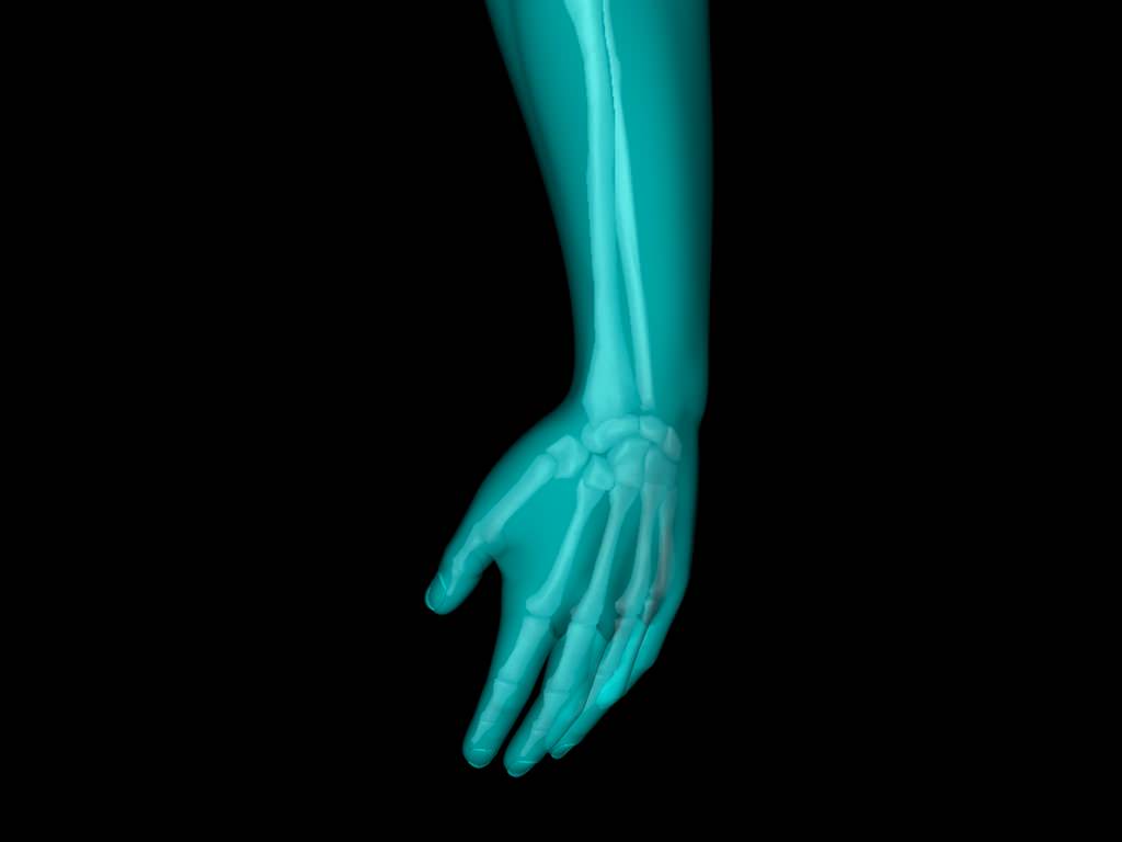 X Ray Hand Medically Accurate 3d Model 3D model_54
