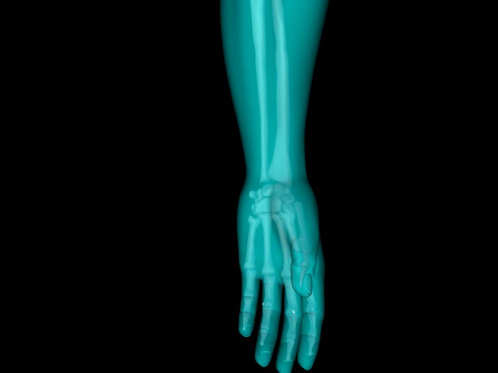 X Ray Hand Medically Accurate 3d Model 3D model_21