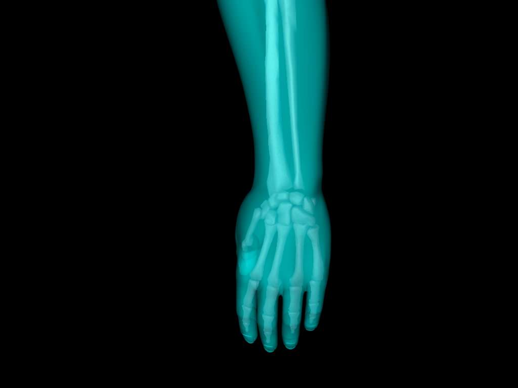 X Ray Hand Medically Accurate 3d Model 3D model_43