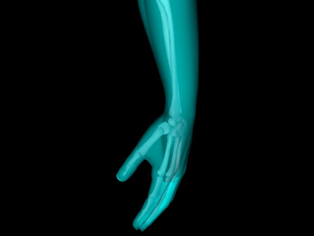 X Ray Hand Medically Accurate 3d Model 3D model_11