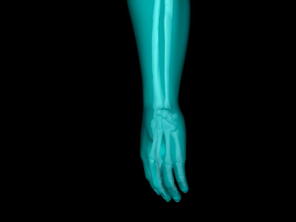 X Ray Hand Medically Accurate 3d Model 3D model_39