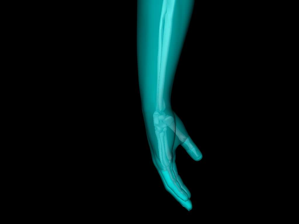 X Ray Hand Medically Accurate 3d Model 3D model_33