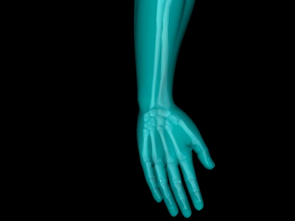 X Ray Hand Medically Accurate 3d Model 3D model_26