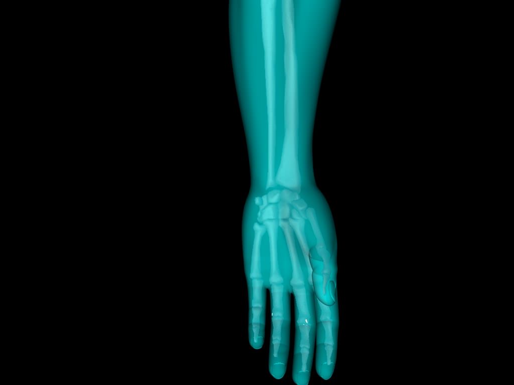 X Ray Hand Medically Accurate 3d Model 3D model_22