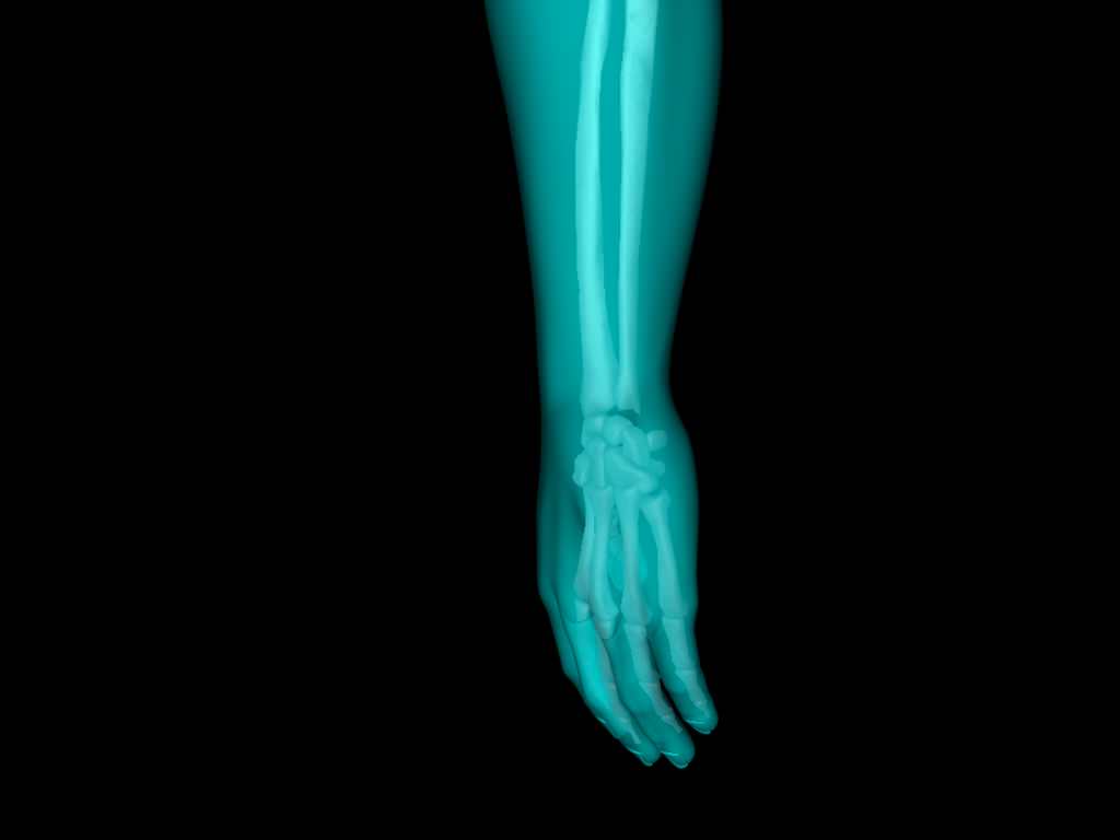 X Ray Hand Medically Accurate 3d Model 3D model_38