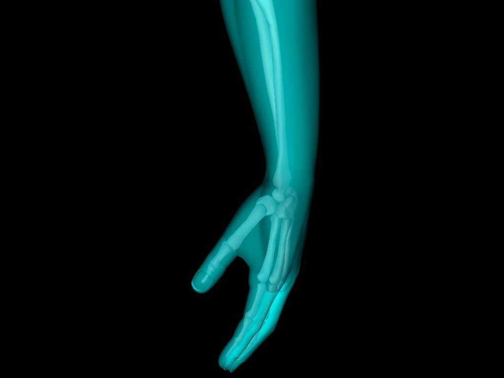 X Ray Hand Medically Accurate 3d Model 3D model_12