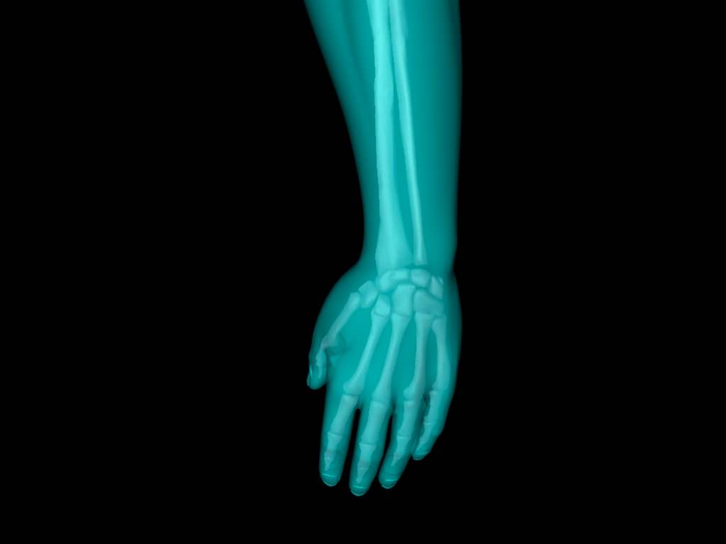 X Ray Hand Medically Accurate 3d Model 3D model_46