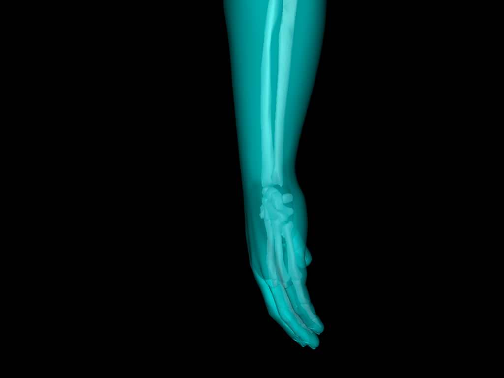 X Ray Hand Medically Accurate 3d Model 3D model_36