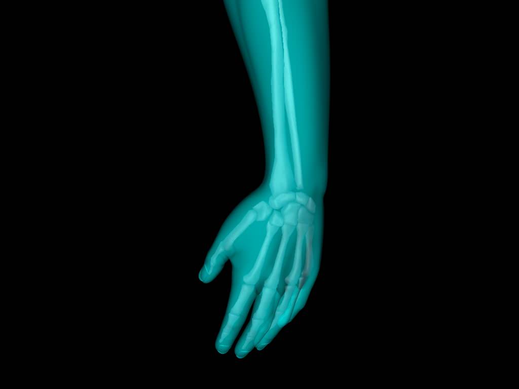 X Ray Hand Medically Accurate 3d Model 3D model_53