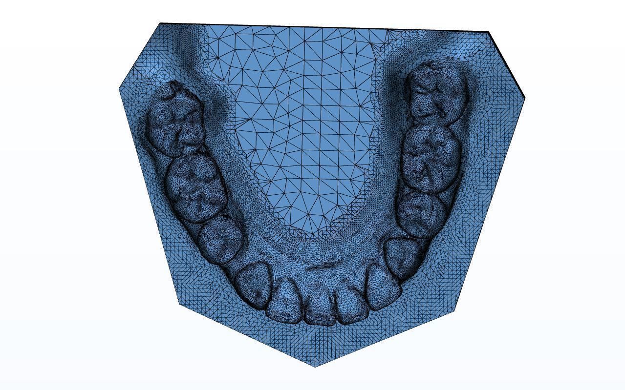 Teen Dental  Study Model 3D print model_12