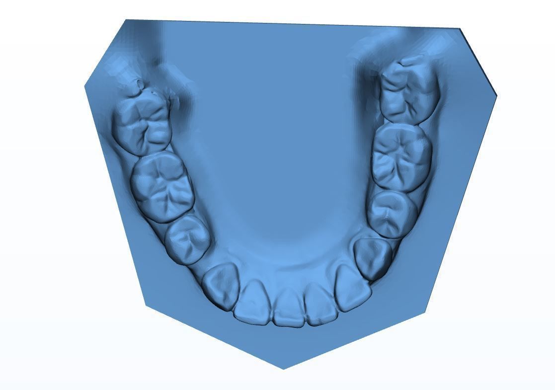 Teen Dental  Study Model 3D print model_11
